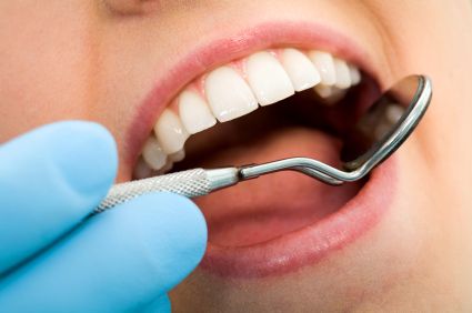 Add dental filling treatment image here